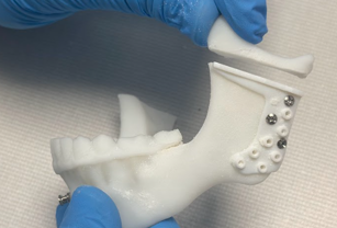 3D Printed Dental Anatomy Models for Clinical Training