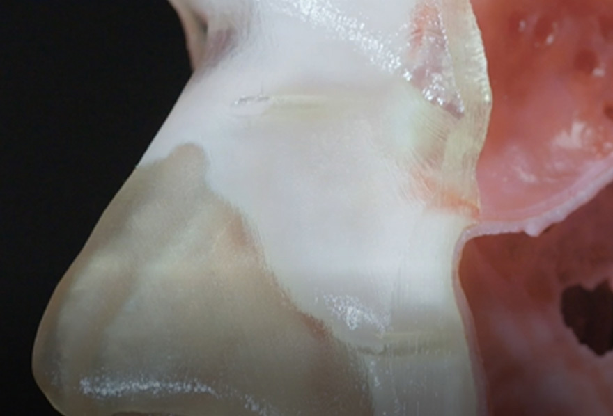 3D printed medical model of a nose.