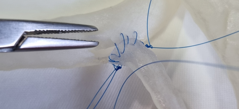 3D Printing Suturable Vascular Models