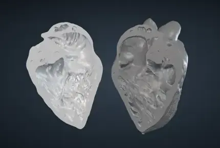 Deep TG RV Inflow View VHL file image for 3d printing