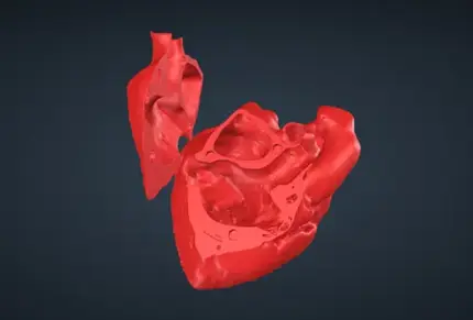 ME Bicaval View VHL file image for 3d printing