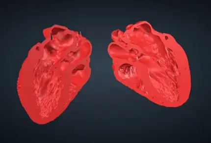 ME LAX VHL file image for 3d printing