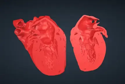 ME Mitral Comm VHL file image for 3d printing