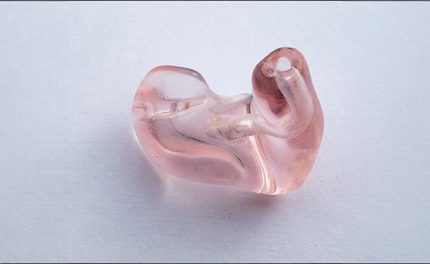 3D Printed Hearing Aid | Stratasys Direct