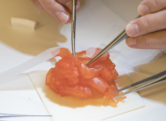 people practicing surgery on 3d printed medical heart model