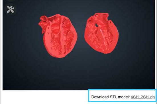 Screenshot of 3D heart file with blue box around the download link for the stl file