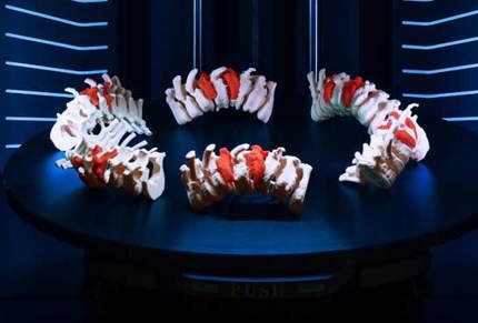 P3 DLP 3D Printed Spine