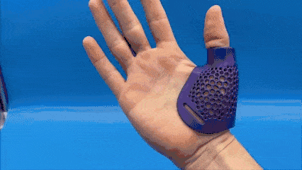 3D Printed hand splint dyed purple made from MJF PA12-W