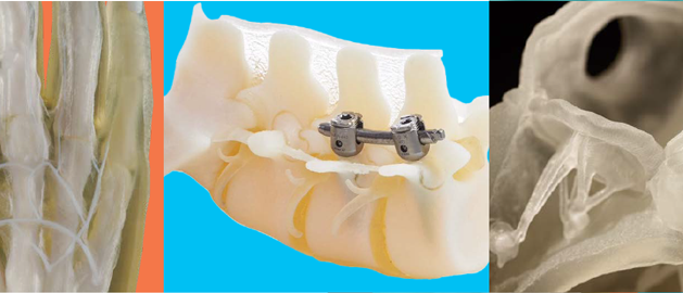 Digital Anatomy Printing - 3D printed medical model collage
