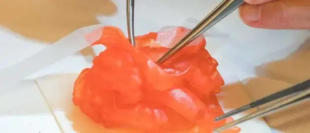3D printed surgical heart model used for medical training